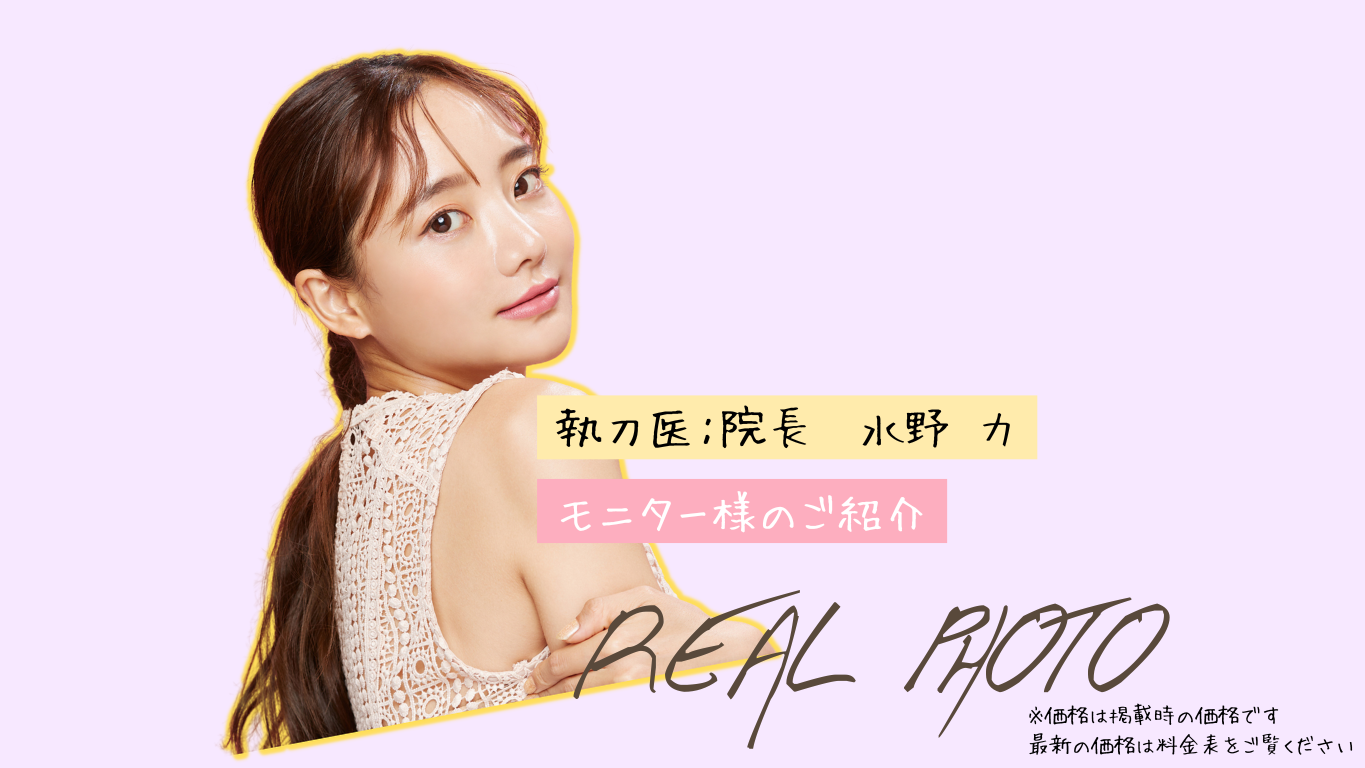輪郭整形モニター