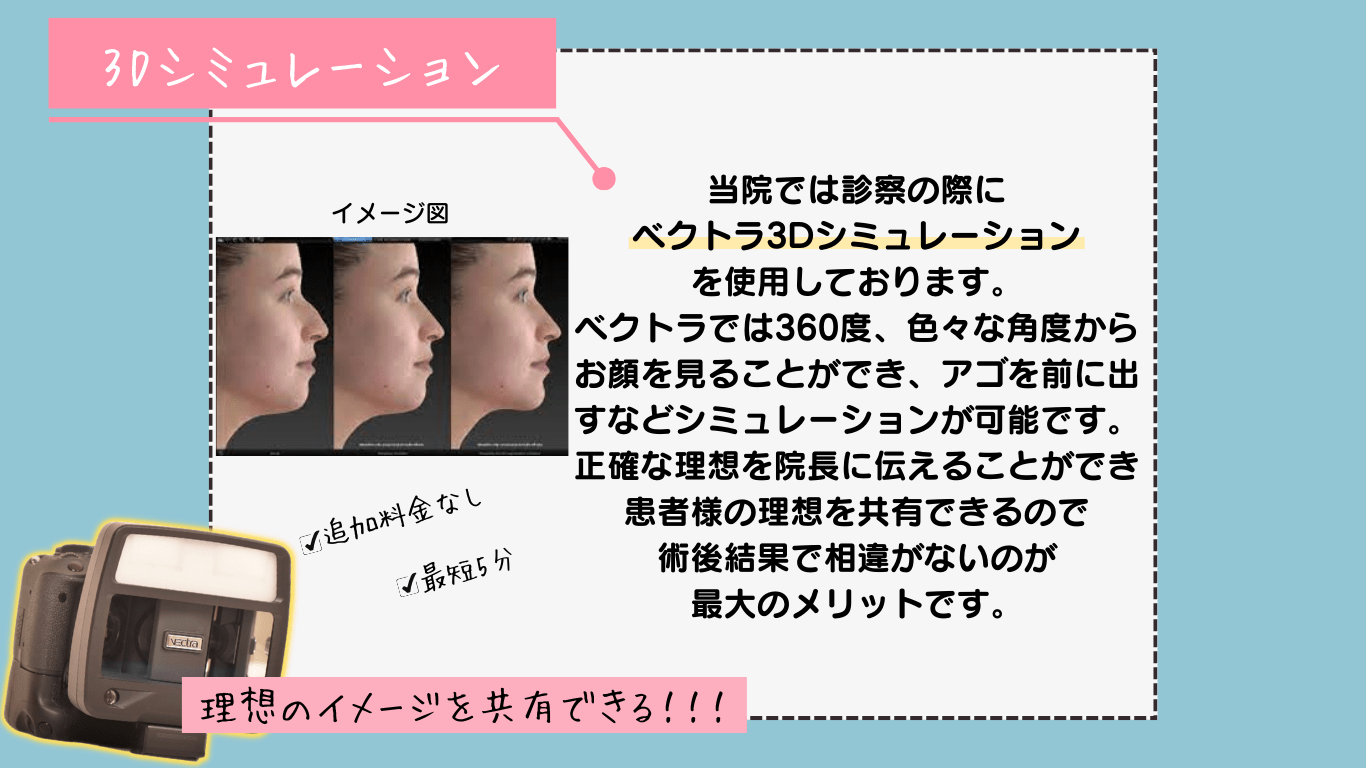 ベクトラ3Dシミュレーション