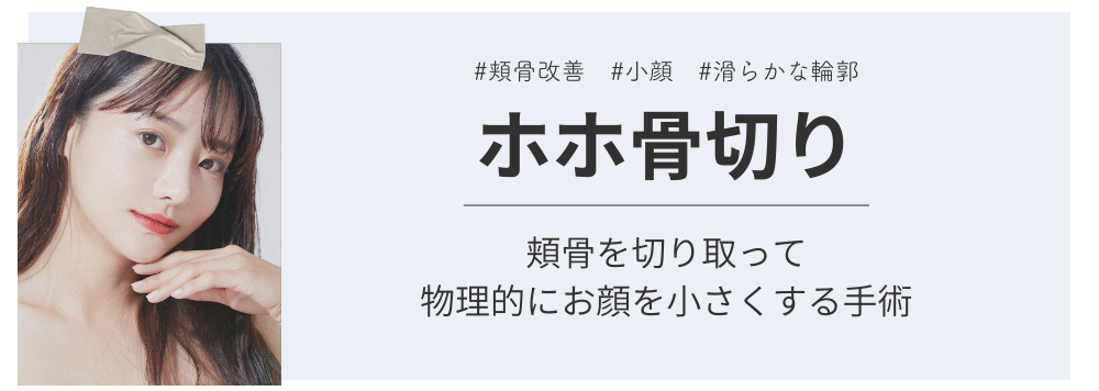 ホホ骨切り