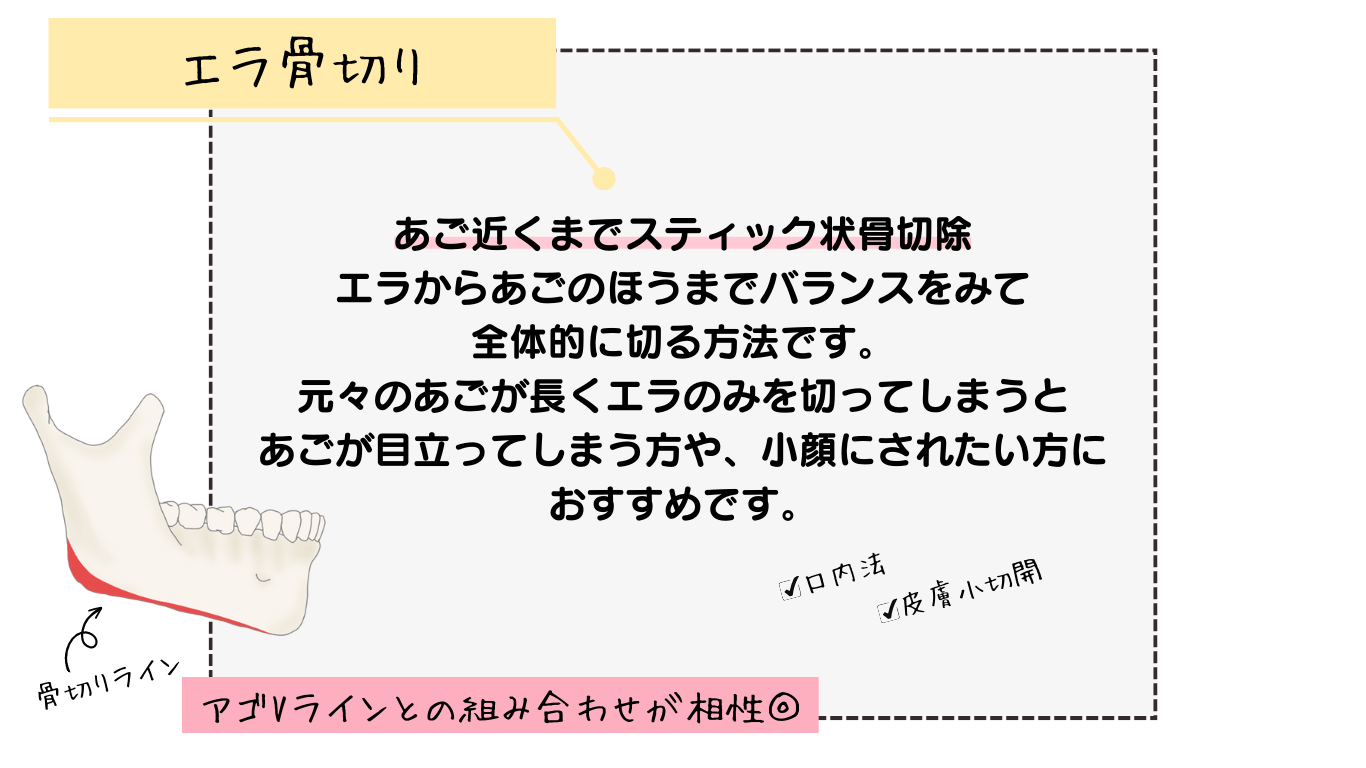エラ骨切り(あご近くまでスティック状骨切除)