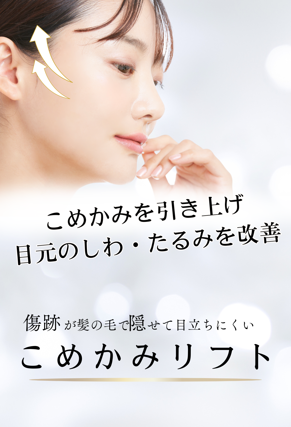 こめかみリフト